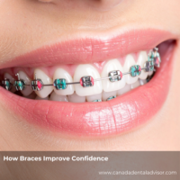 How Braces Improve Confidence