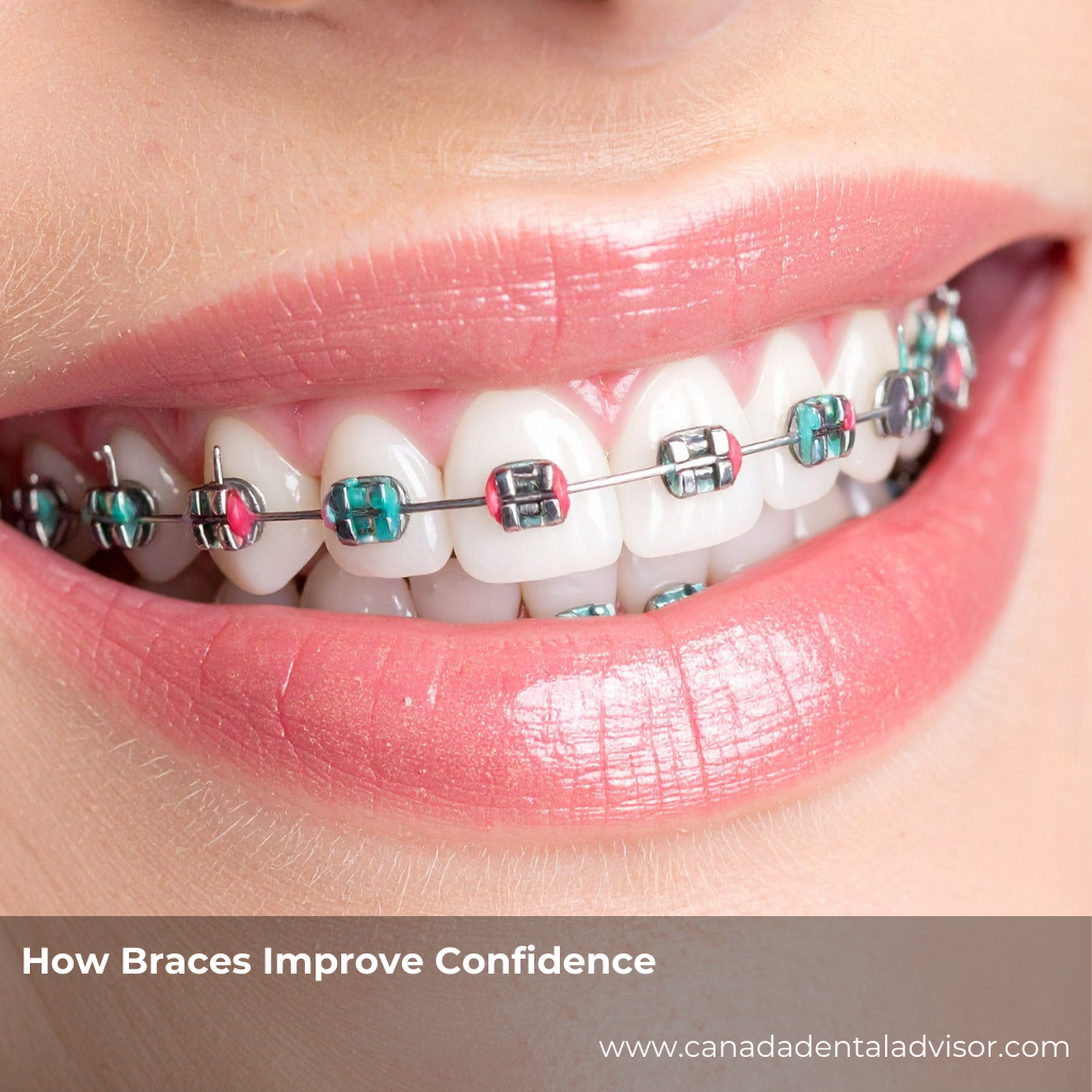 How Braces Improve Confidence