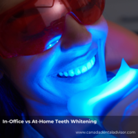In-Office vs At-Home Teeth Whitening