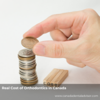 Real Cost of Orthodontics in Canada