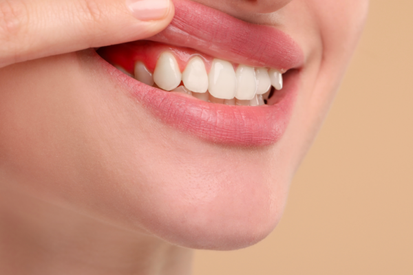 Sensitive Teeth: Causes and Solutions