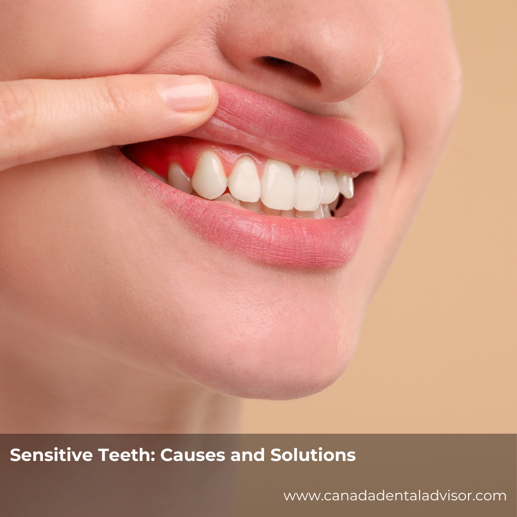 Sensitive Teeth: Causes and Solutions